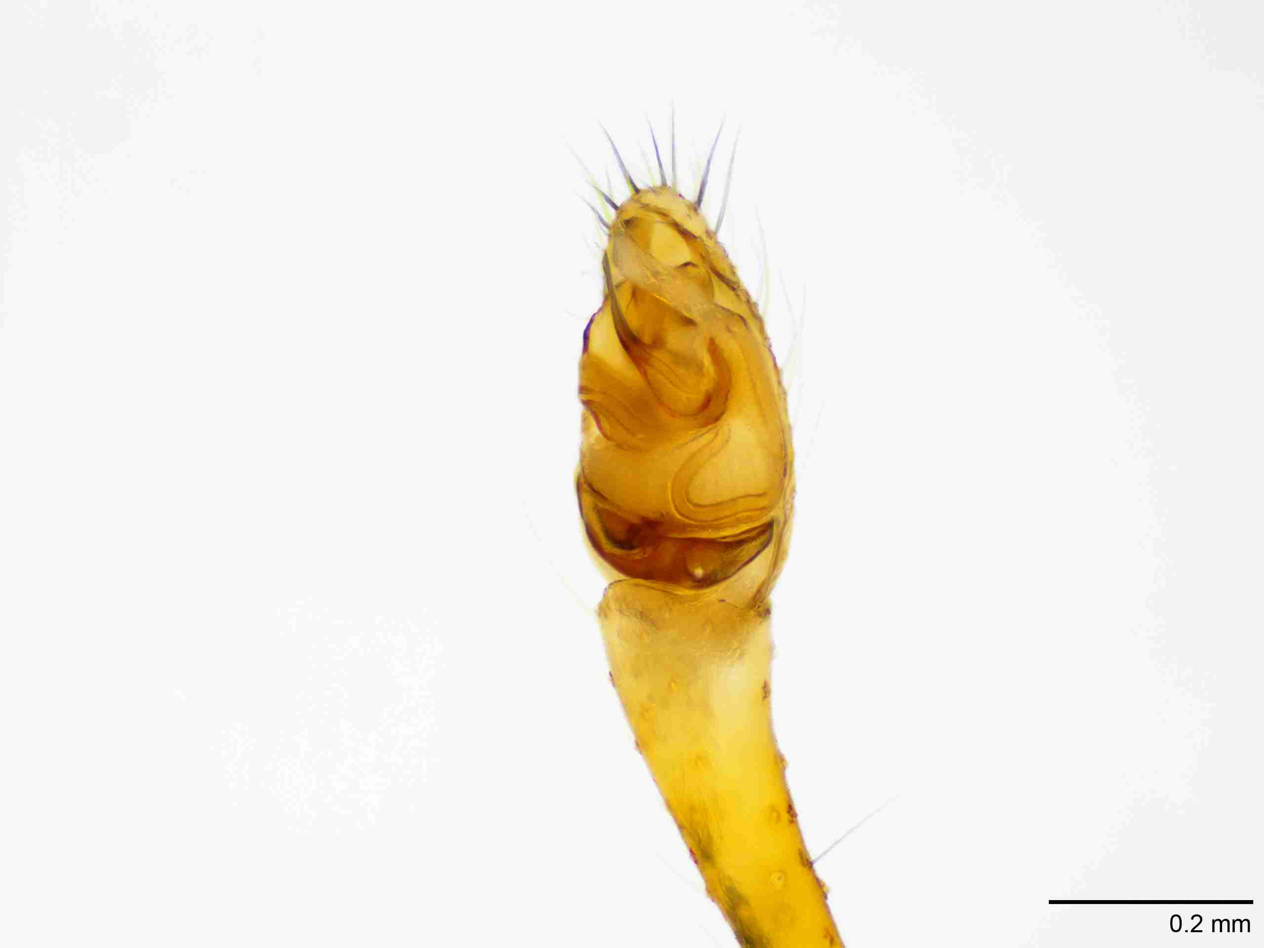 XILTHER155mppalvJAM238_100X_E2A.jpg
