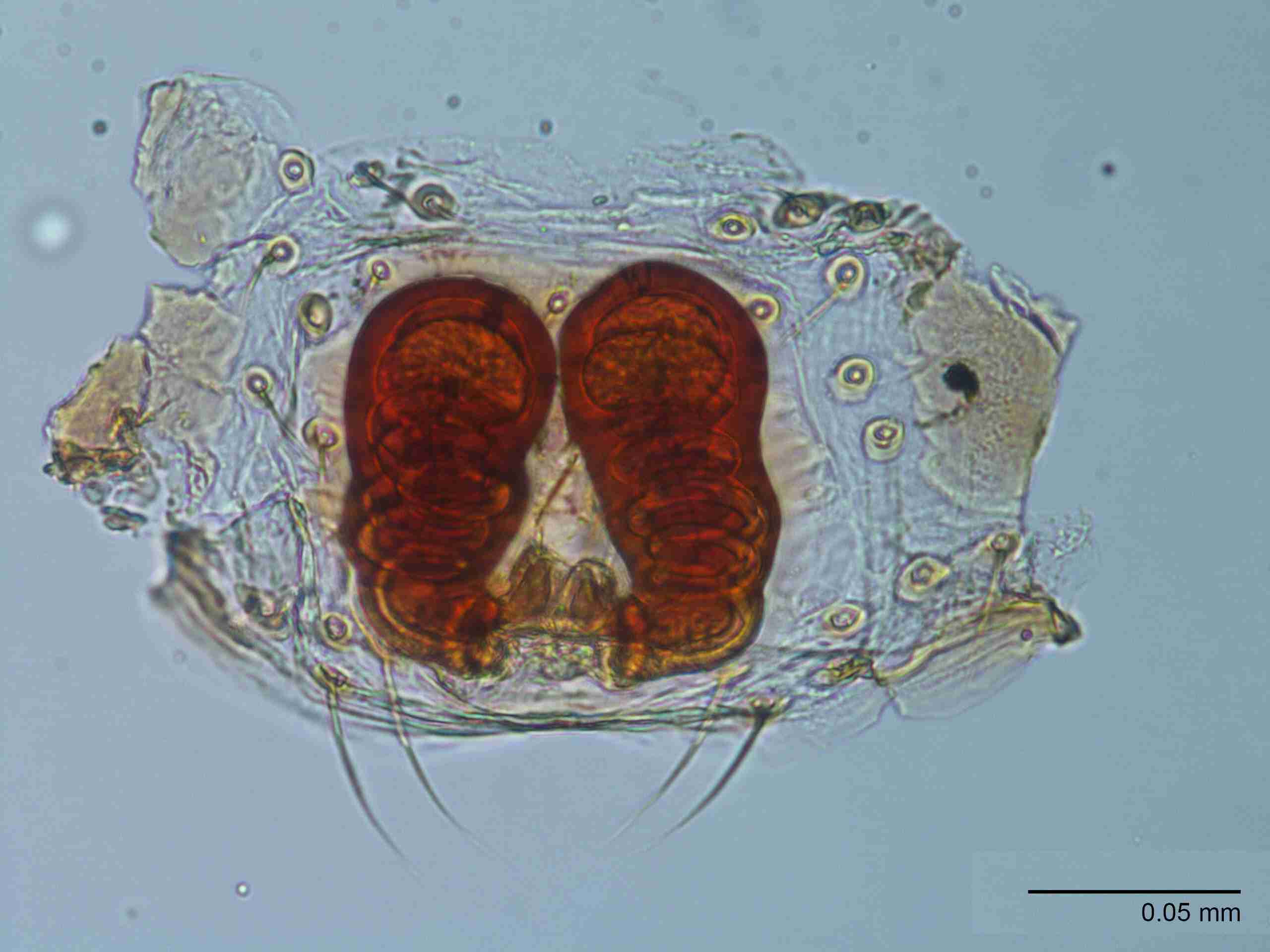 XILTHER157fpepidJAM522_400X_E2A.jpg