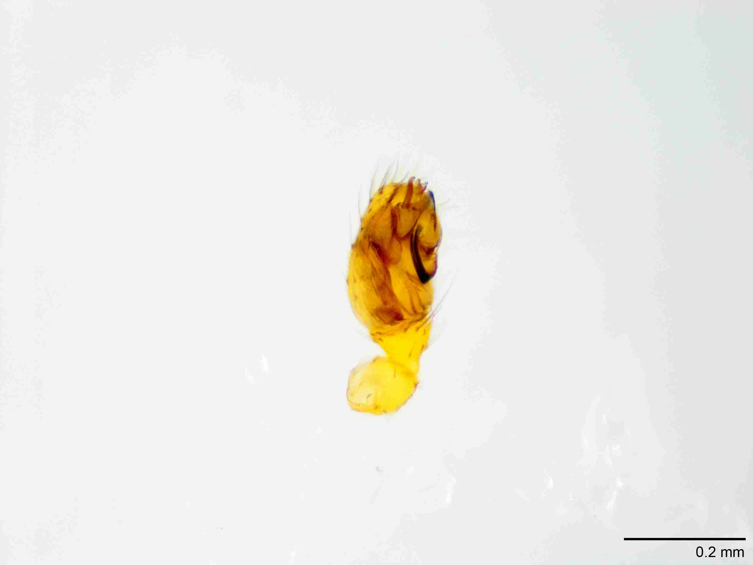 XILTHER158mppalpJAM057_100X_E2A.jpg