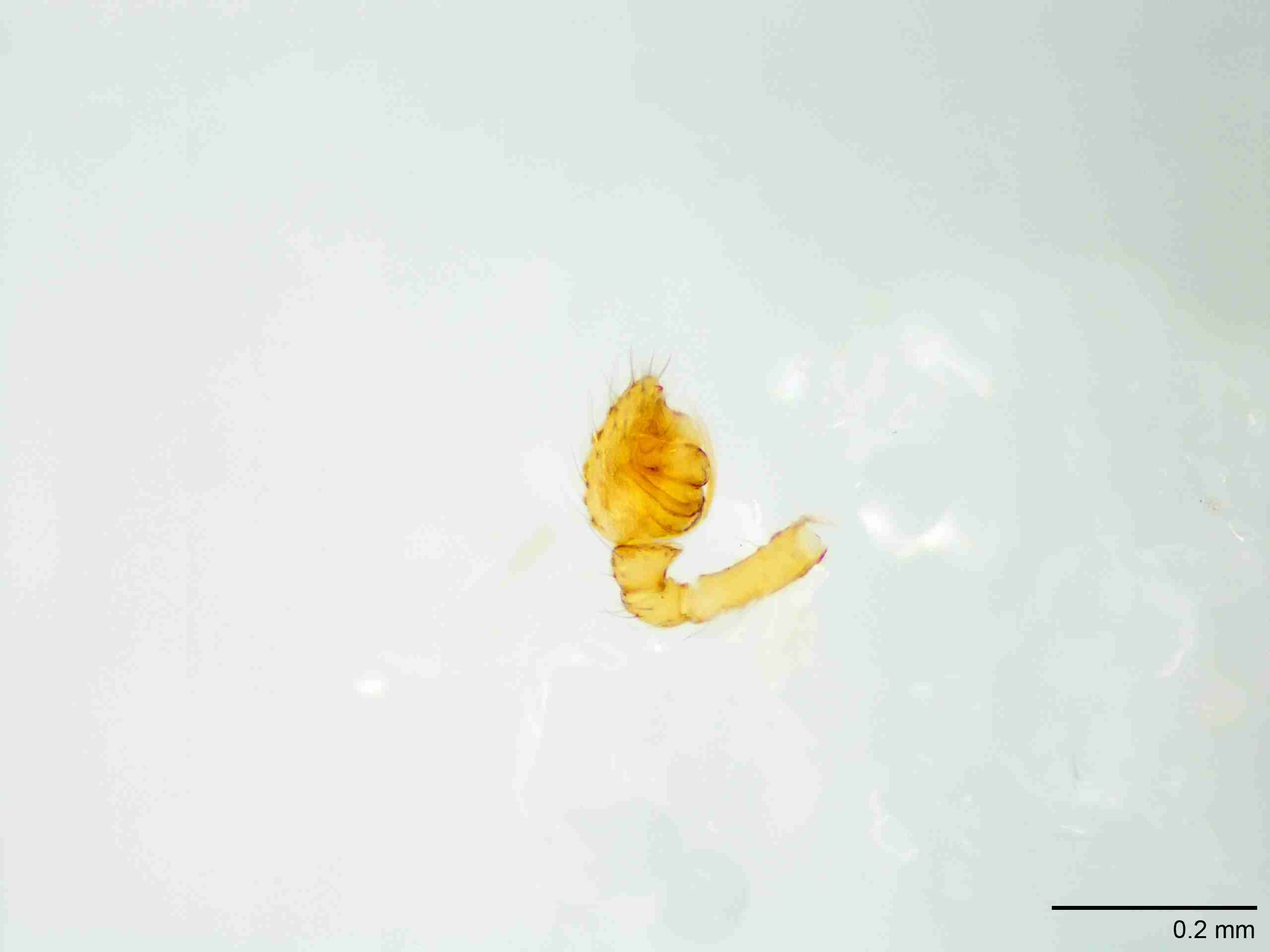 XILTHER159mppalpJAM193_100X_E2A.jpg