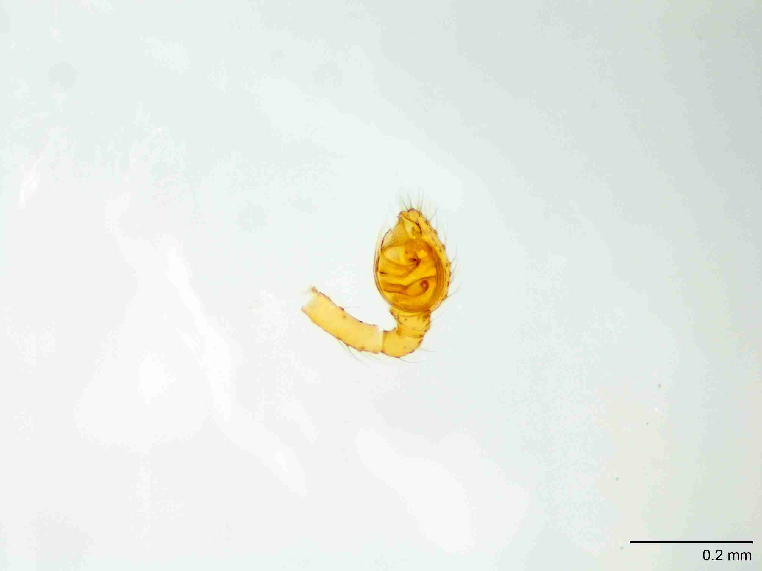 XILTHER159mppalvJAM193_100X_E2A.jpg