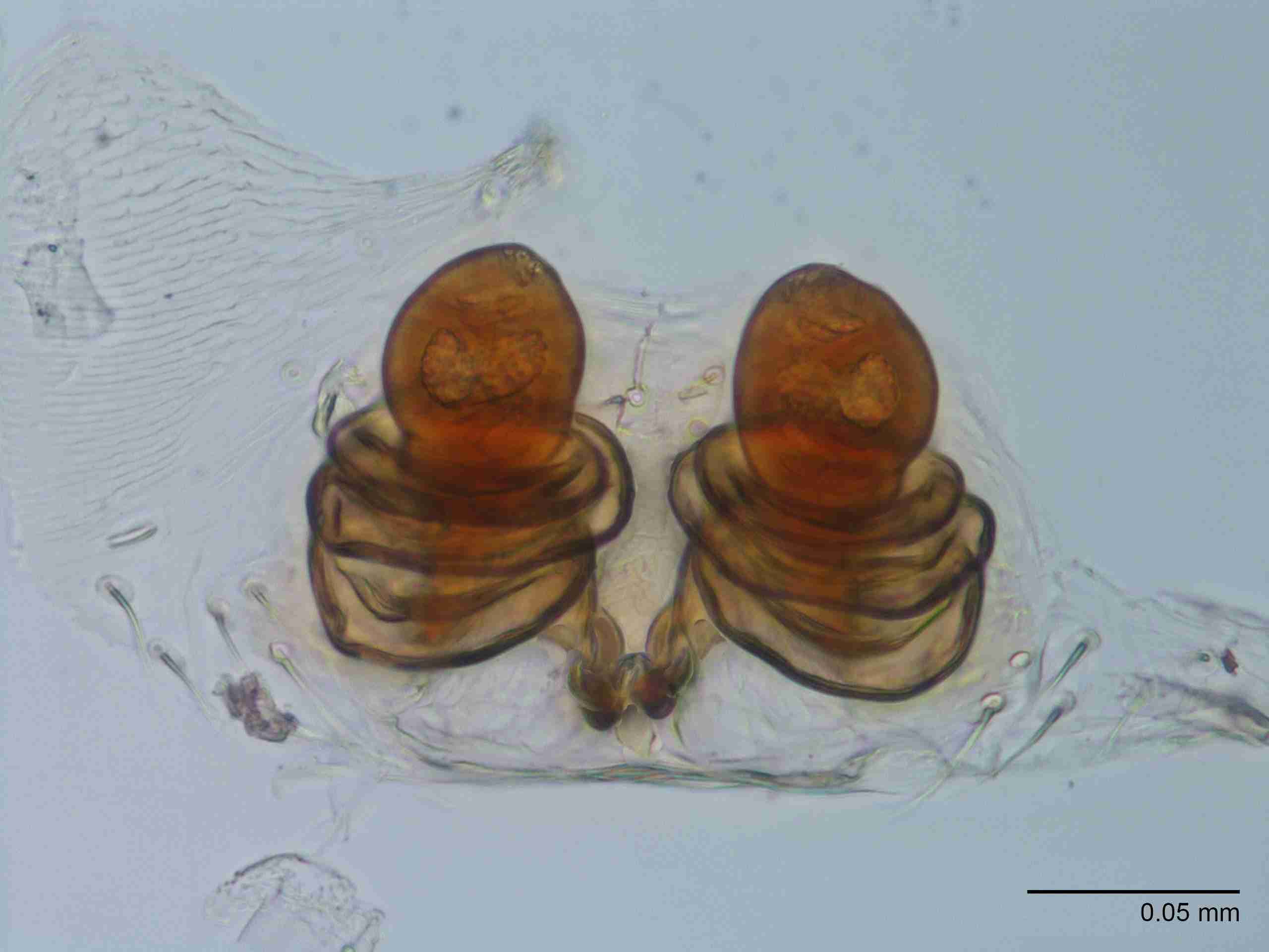 XILTHER160fpepidJAM413_400X_E2A.jpg