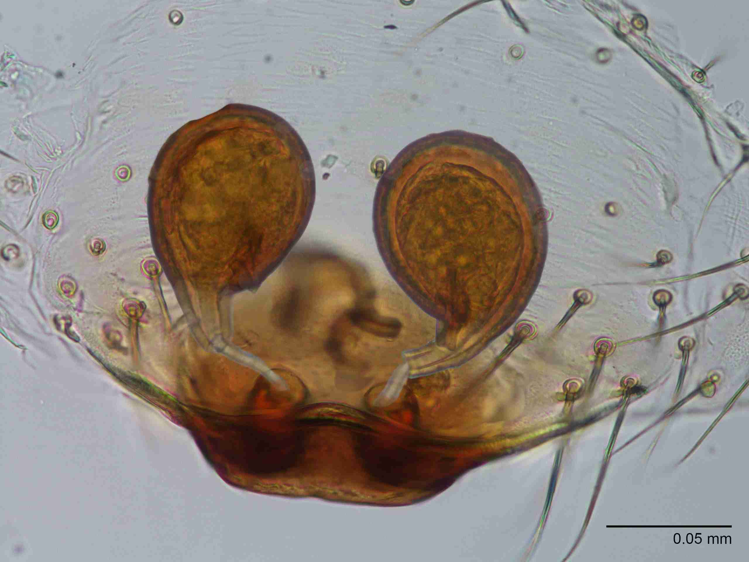 XILTHER167fpepidJAM415_400X_E2A.jpg