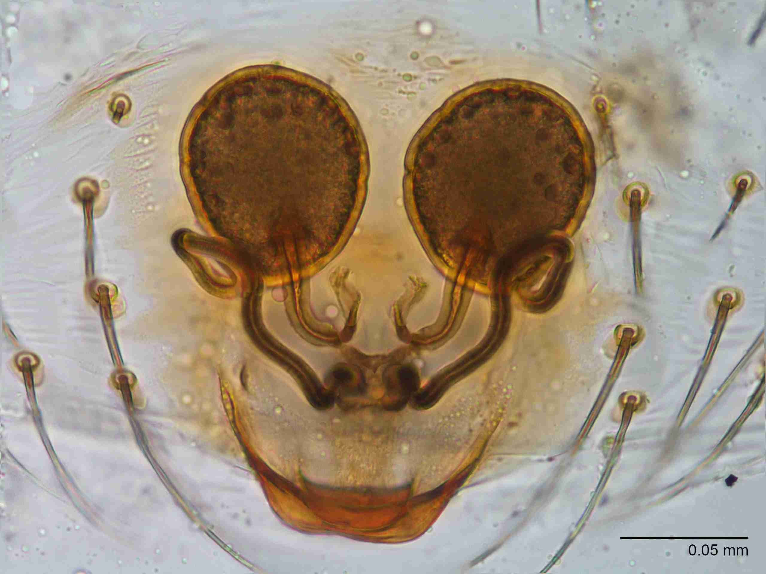 XILTHER168fpepidJAM519_400X_E2A.jpg