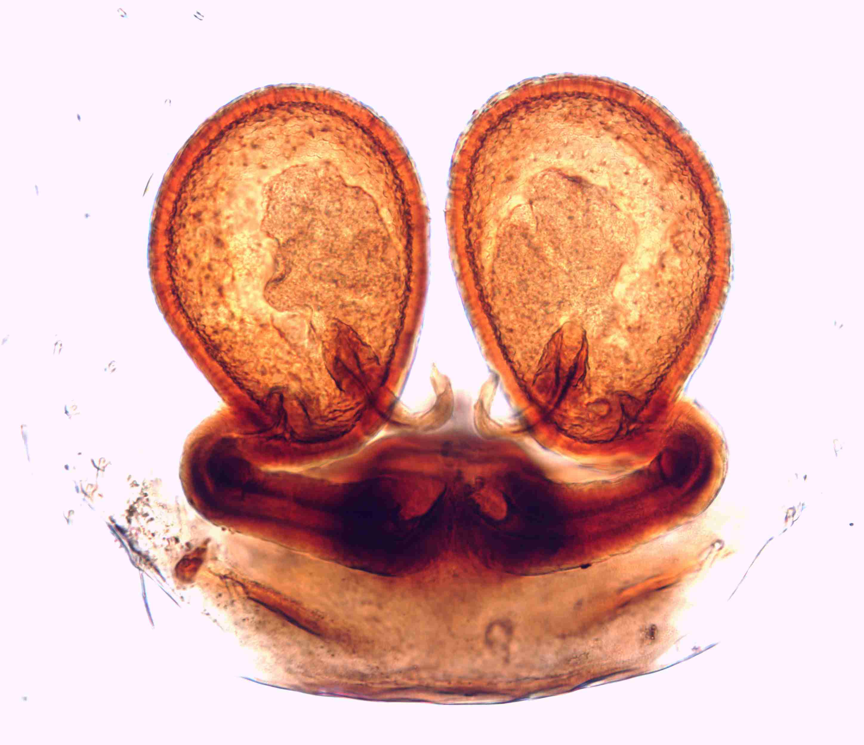 XILTHER163fpepidJAM316_200X_CAS.jpg