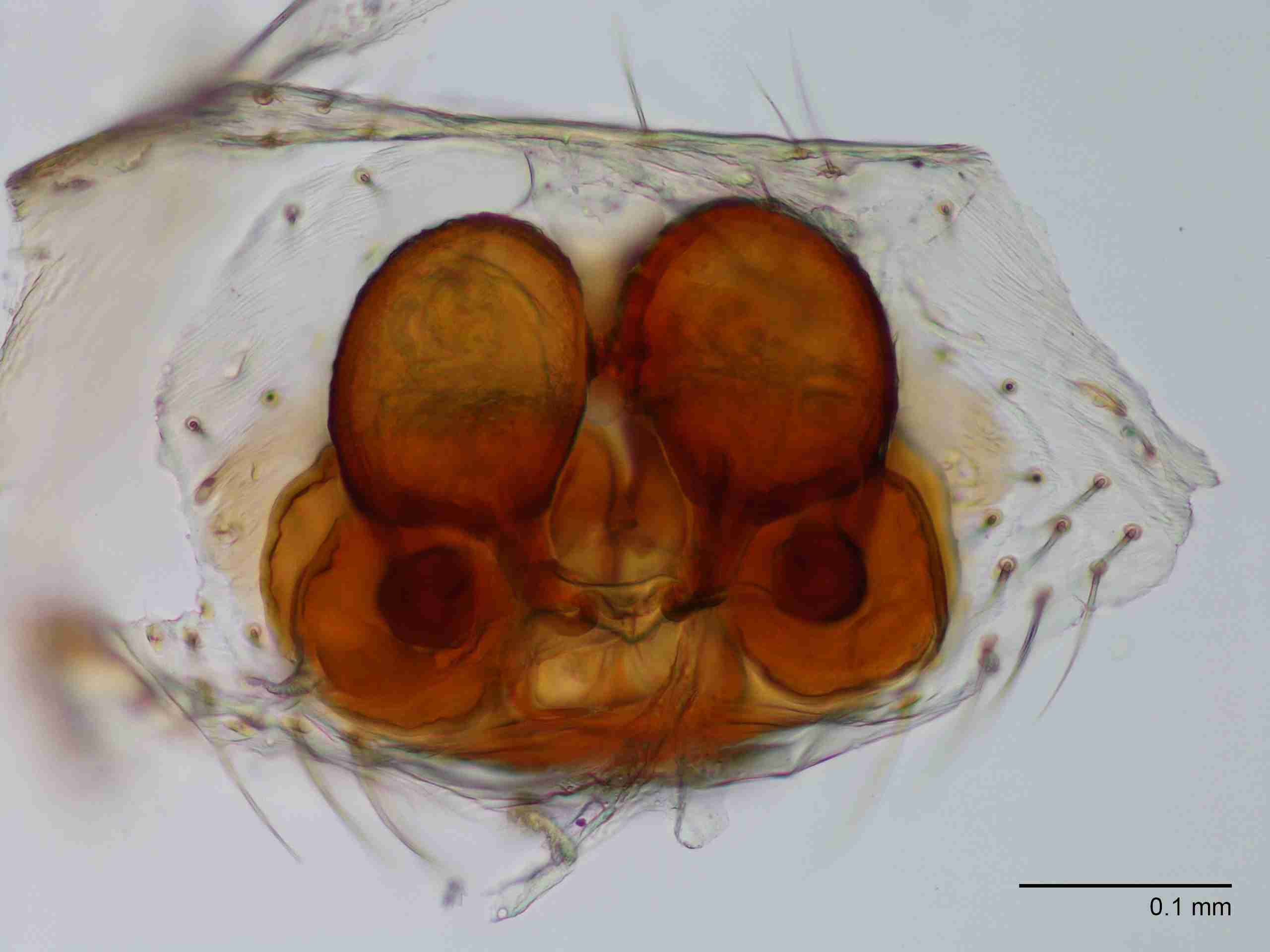 XILTHER164fpepidJAM179_200X_CAS.jpg