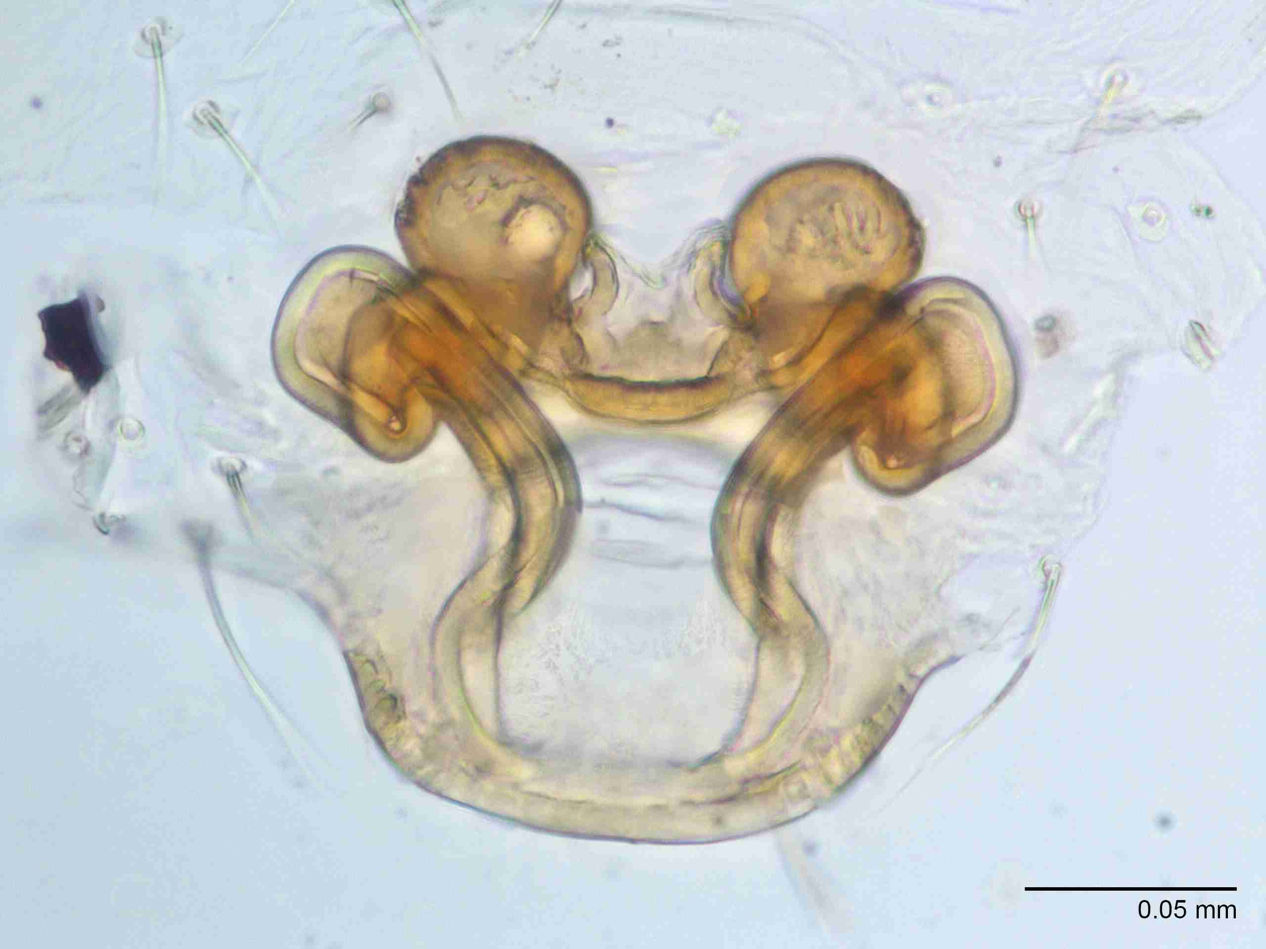XILTHER165fpepidJAM150_400X_E2A.jpg