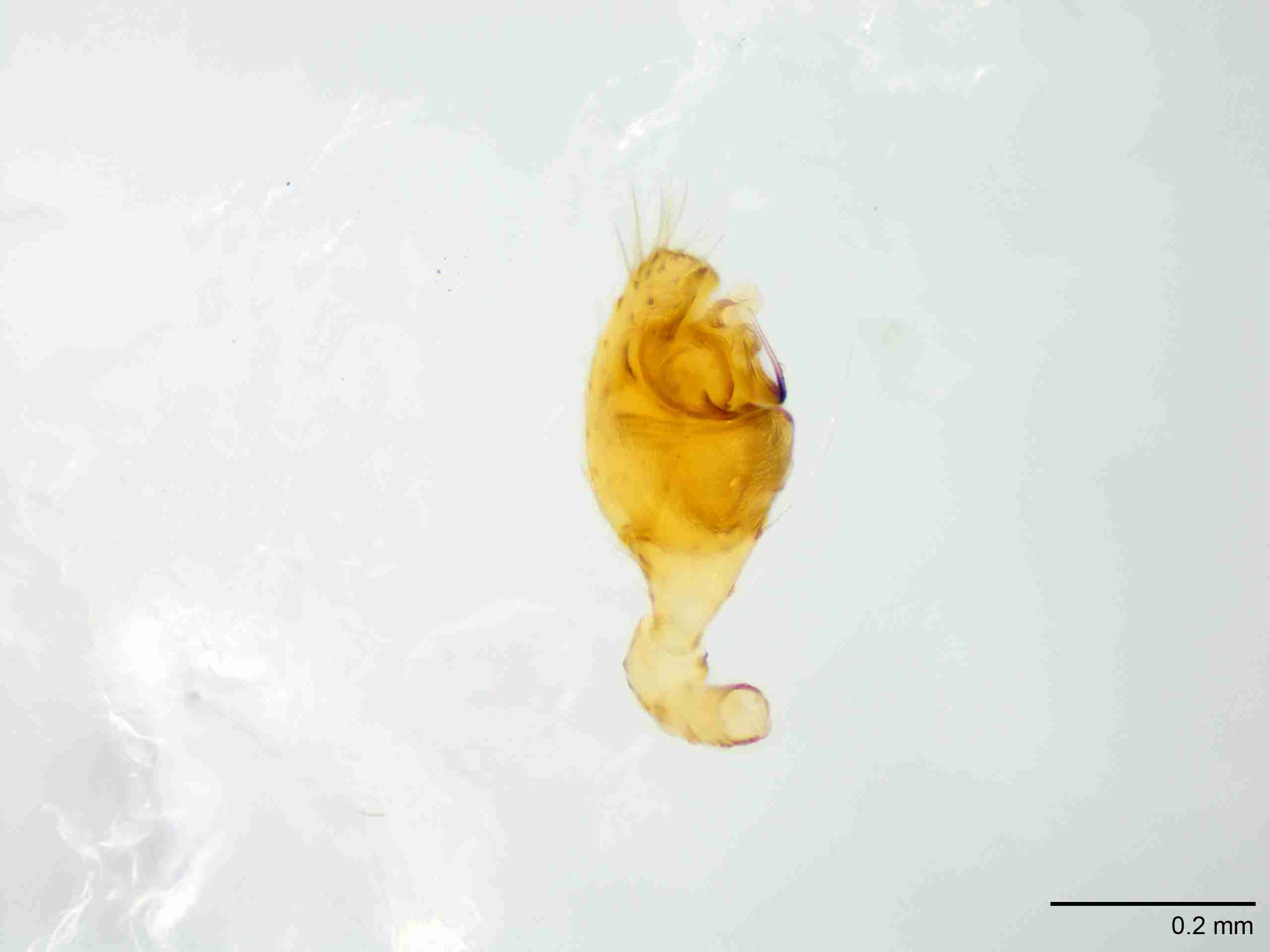 XILTHER165mppalpJAM124_100X_E2A.jpg