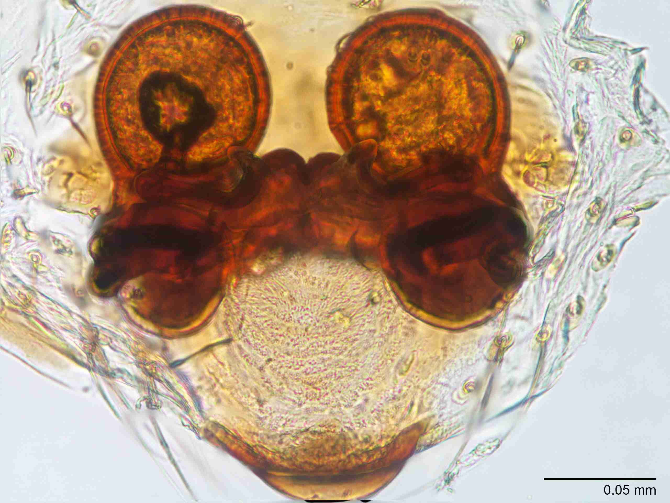 XILTHER173fpepidJAM521_400X_E2A.jpg