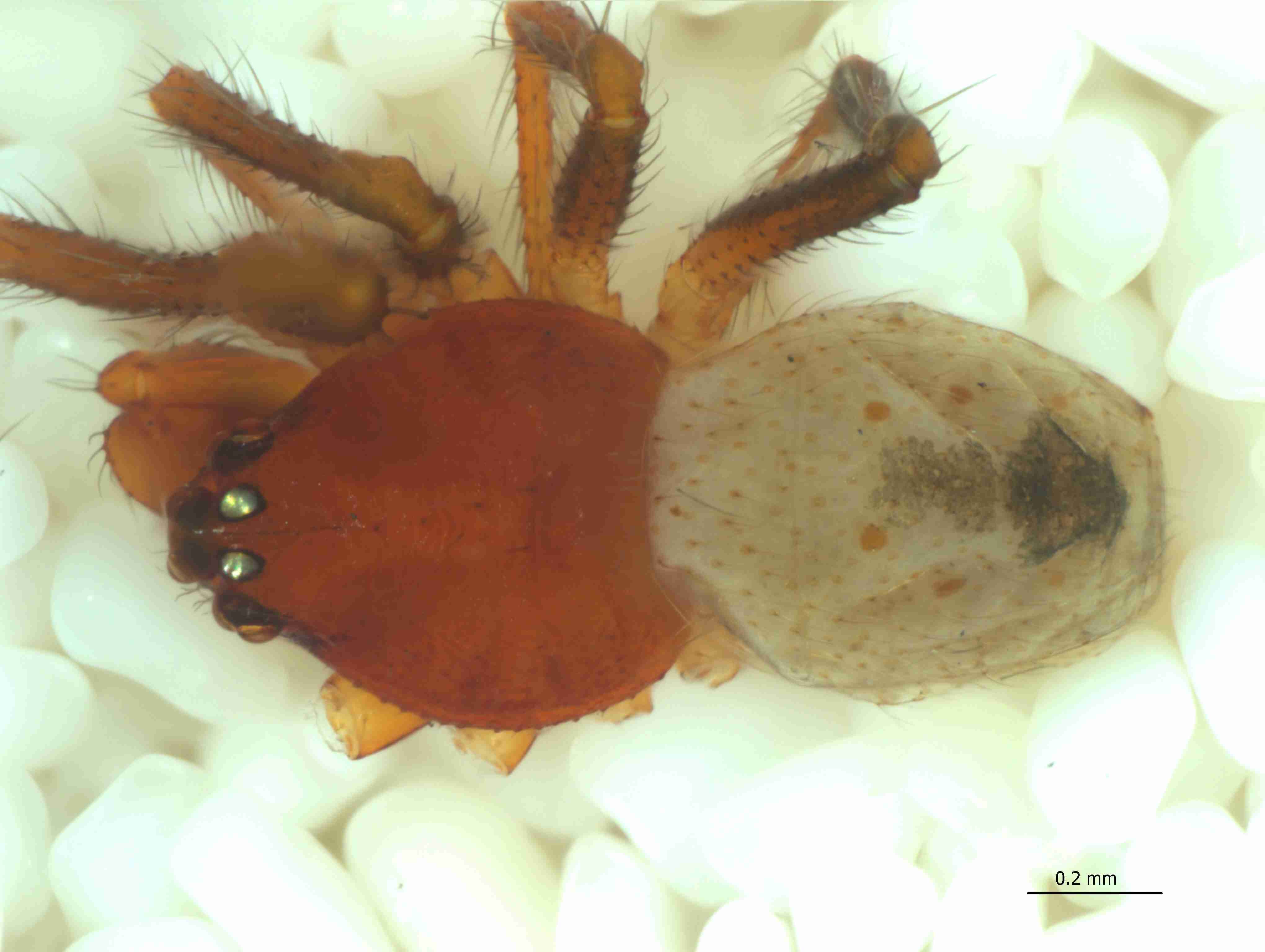 XILTHER174mphabdJAM322_73X_CAS.jpg