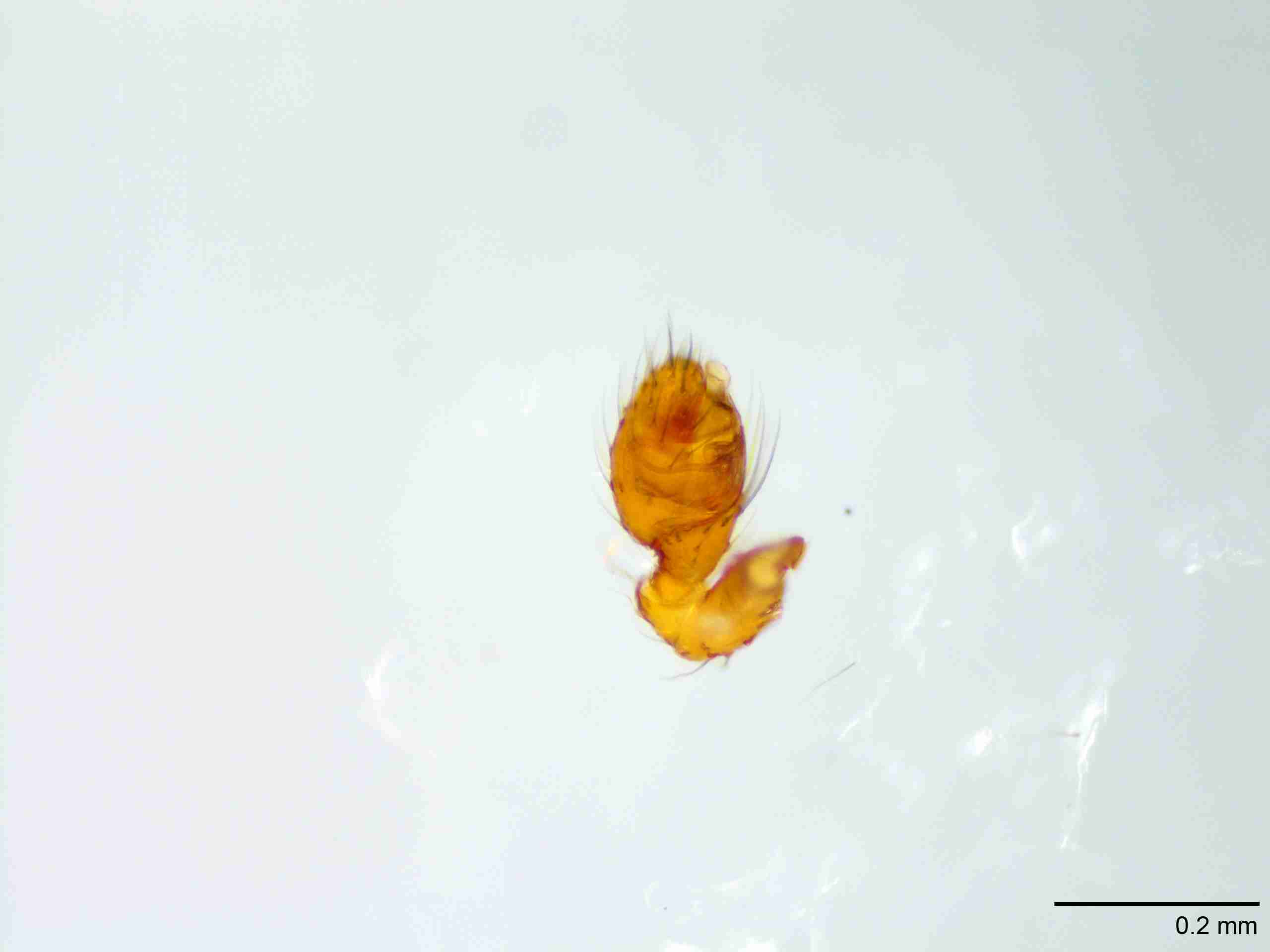 XILTHER176mppalpJAM523_100X_E2A.jpg