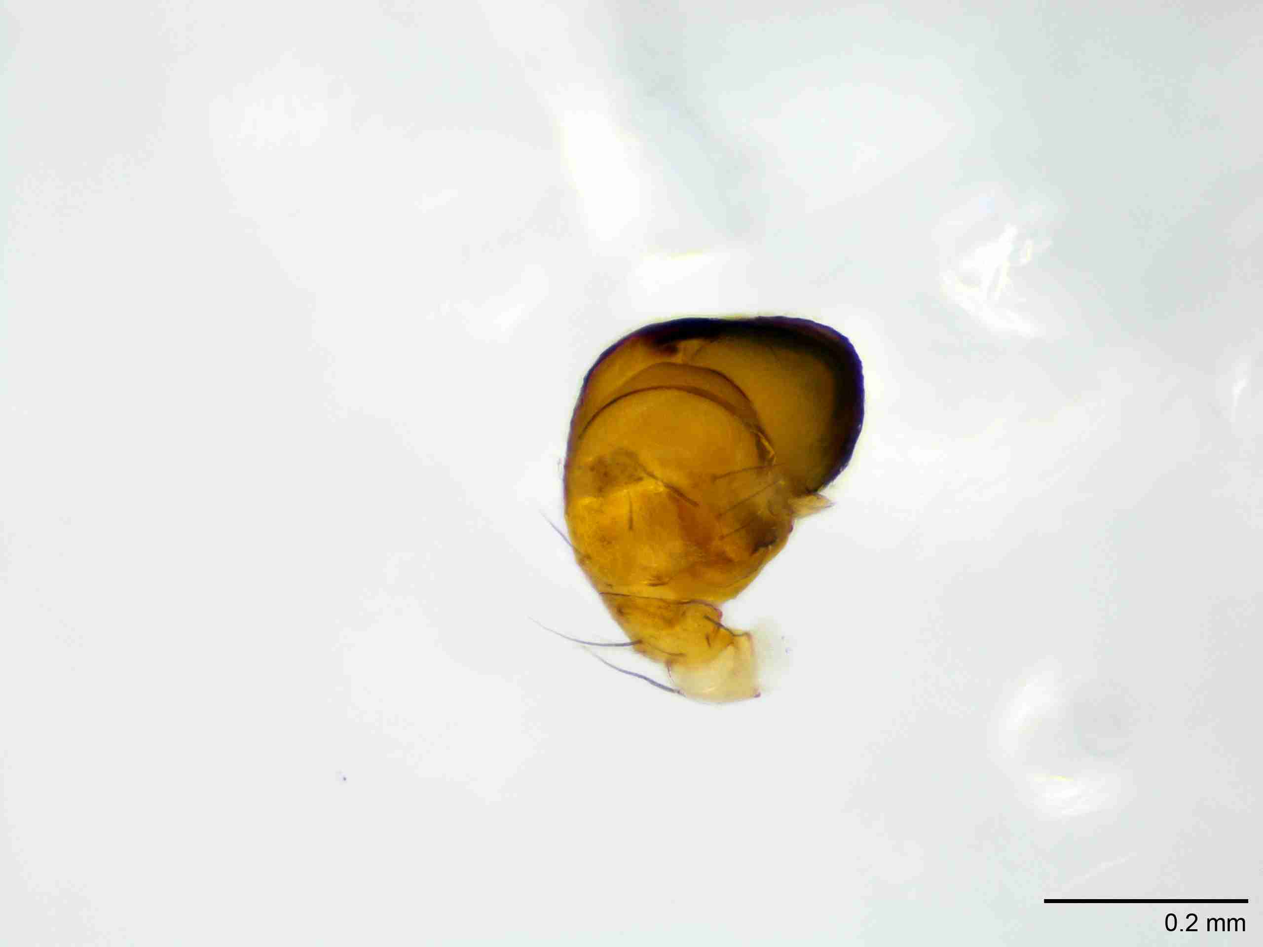 XILTHER182mppaldJAM065_100X_E2A.jpg