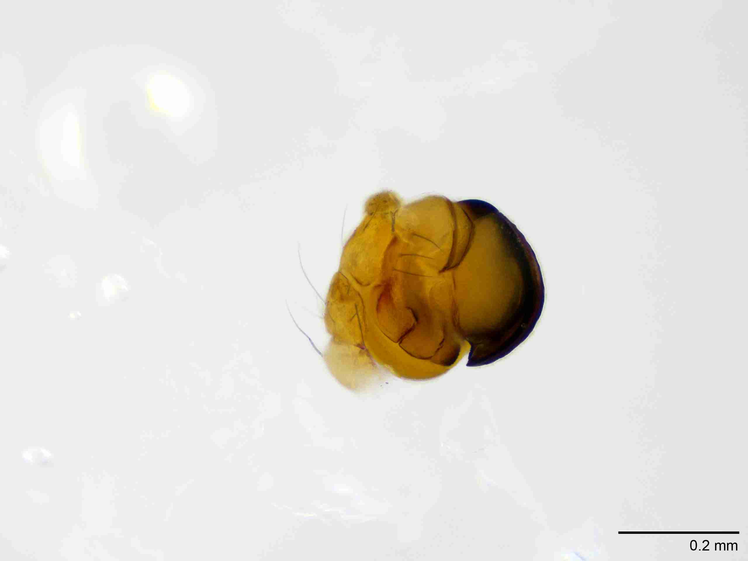XILTHER182mppalpJAM065_100X_E2A.jpg