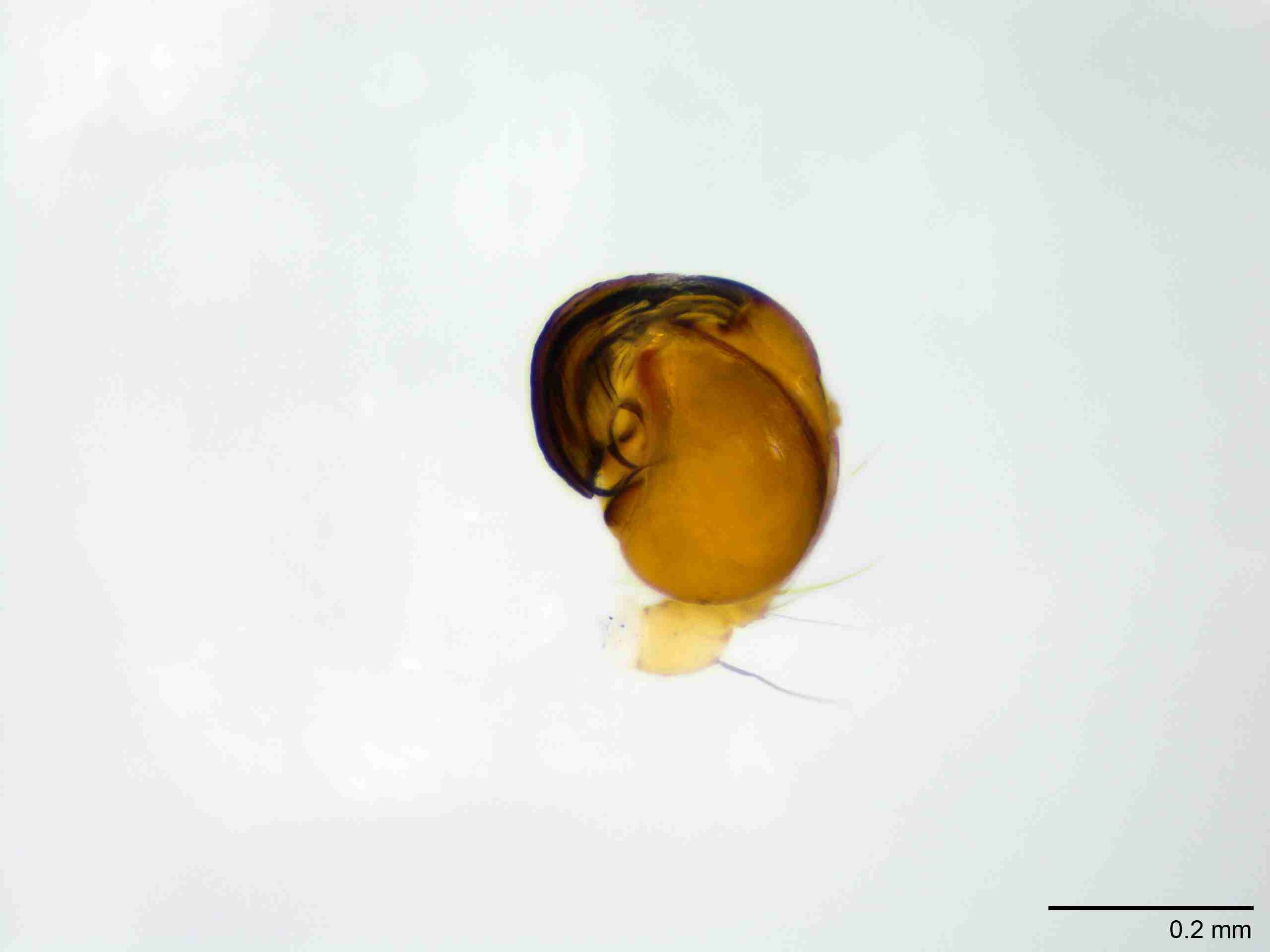 XILTHER182mppalvJAM065_100X_E2A.jpg