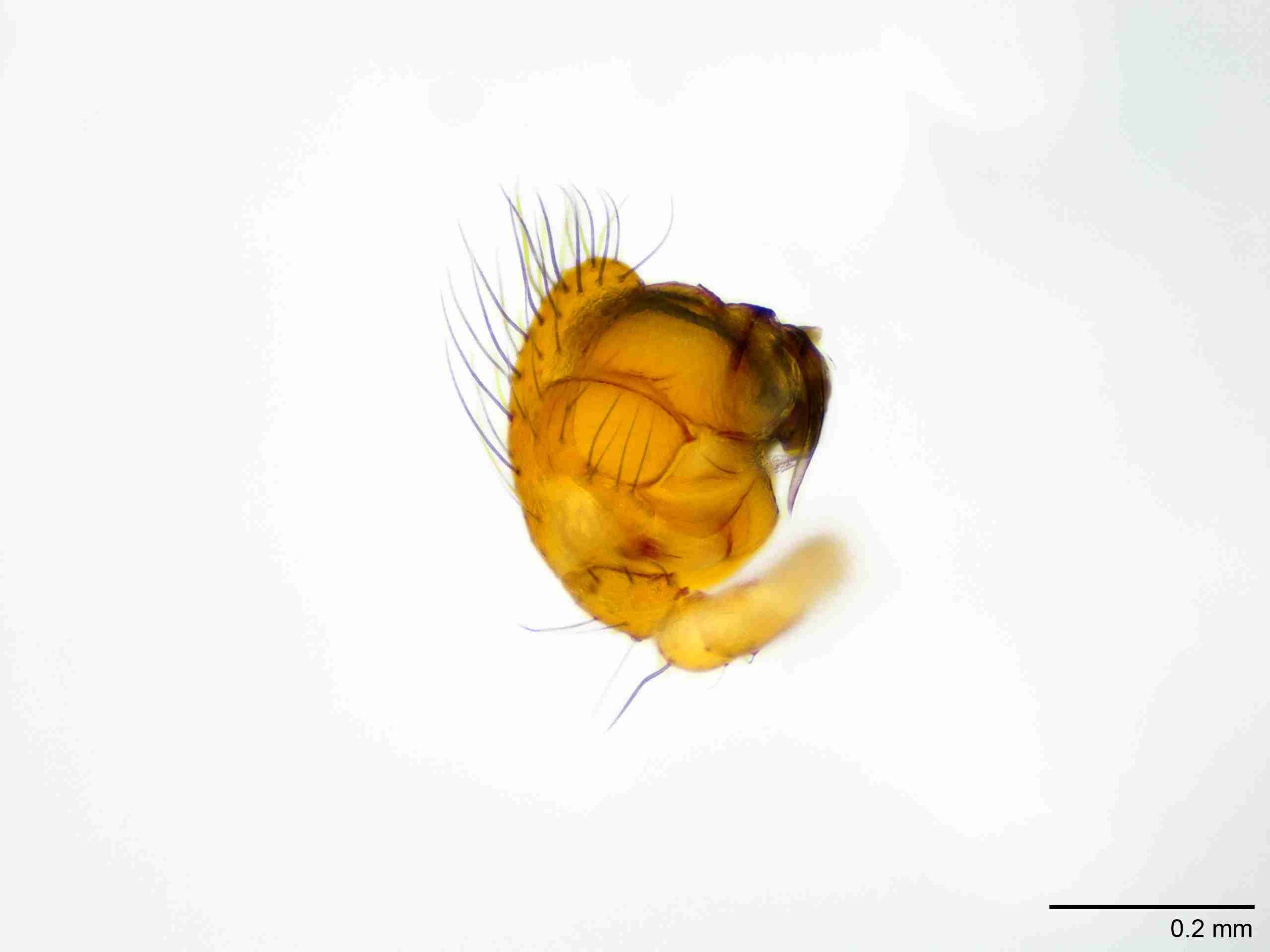 XILTHER183mppalpJAM066_100X_E2A.jpg