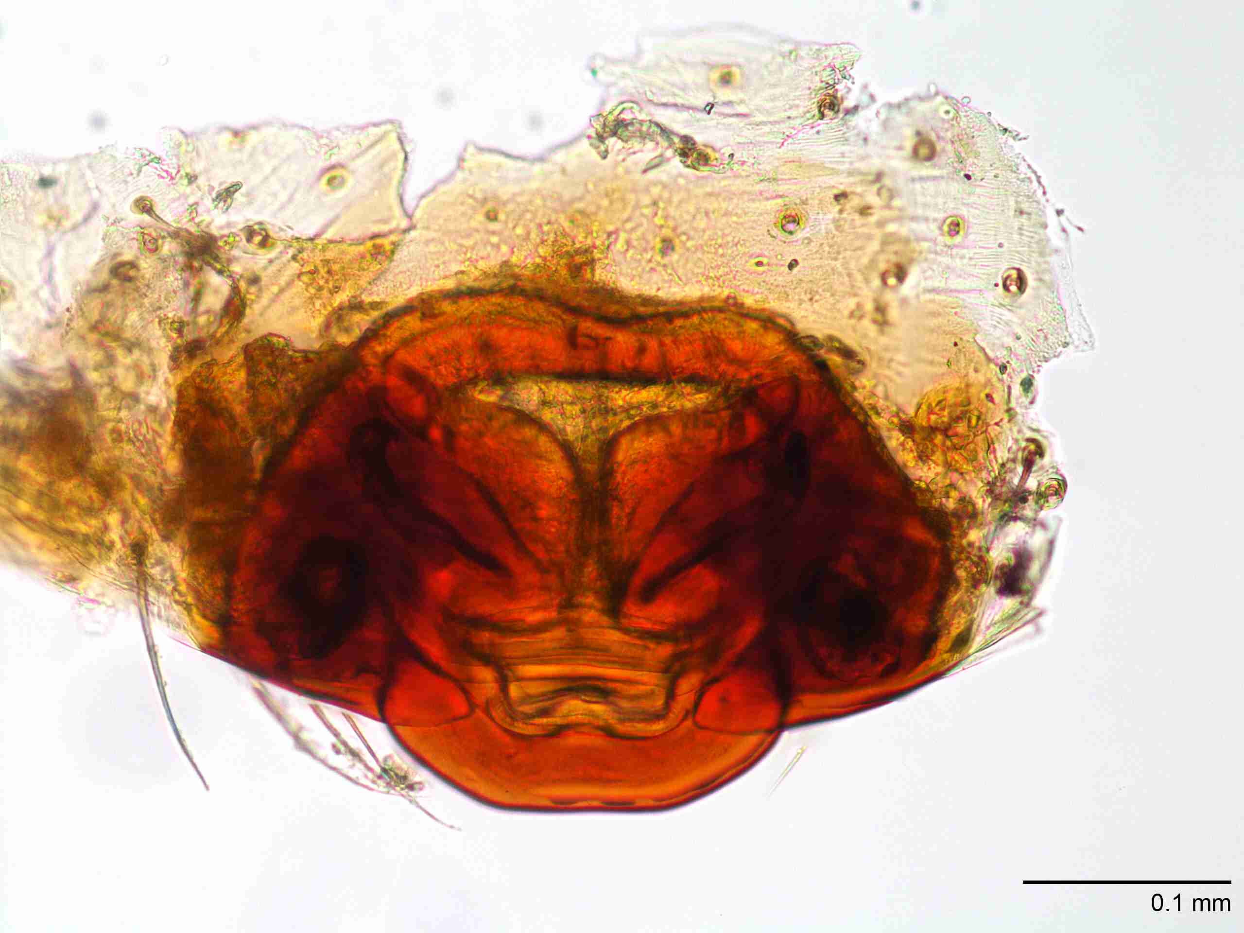 XILZODA203fpepidJAM886_200X_CAS.jpg